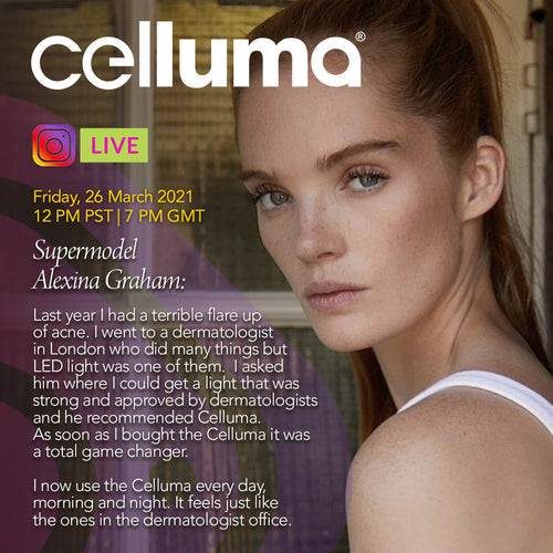 Aknebehandlung mit Celluma-Phototherapie: Alexina Graham wählt medizinische LED für die Selbstbehandlung zu Hause